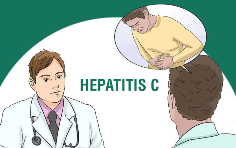 Jaundice Hepatitis A, B & C Facts: Causes, Types, Possible Treatments ...