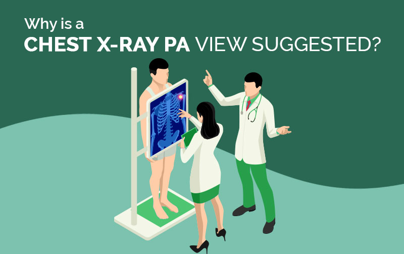 Get The Best Chest X Ray PA View Option & Price in Kolkata Accuhealth